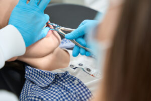 tooth extraction